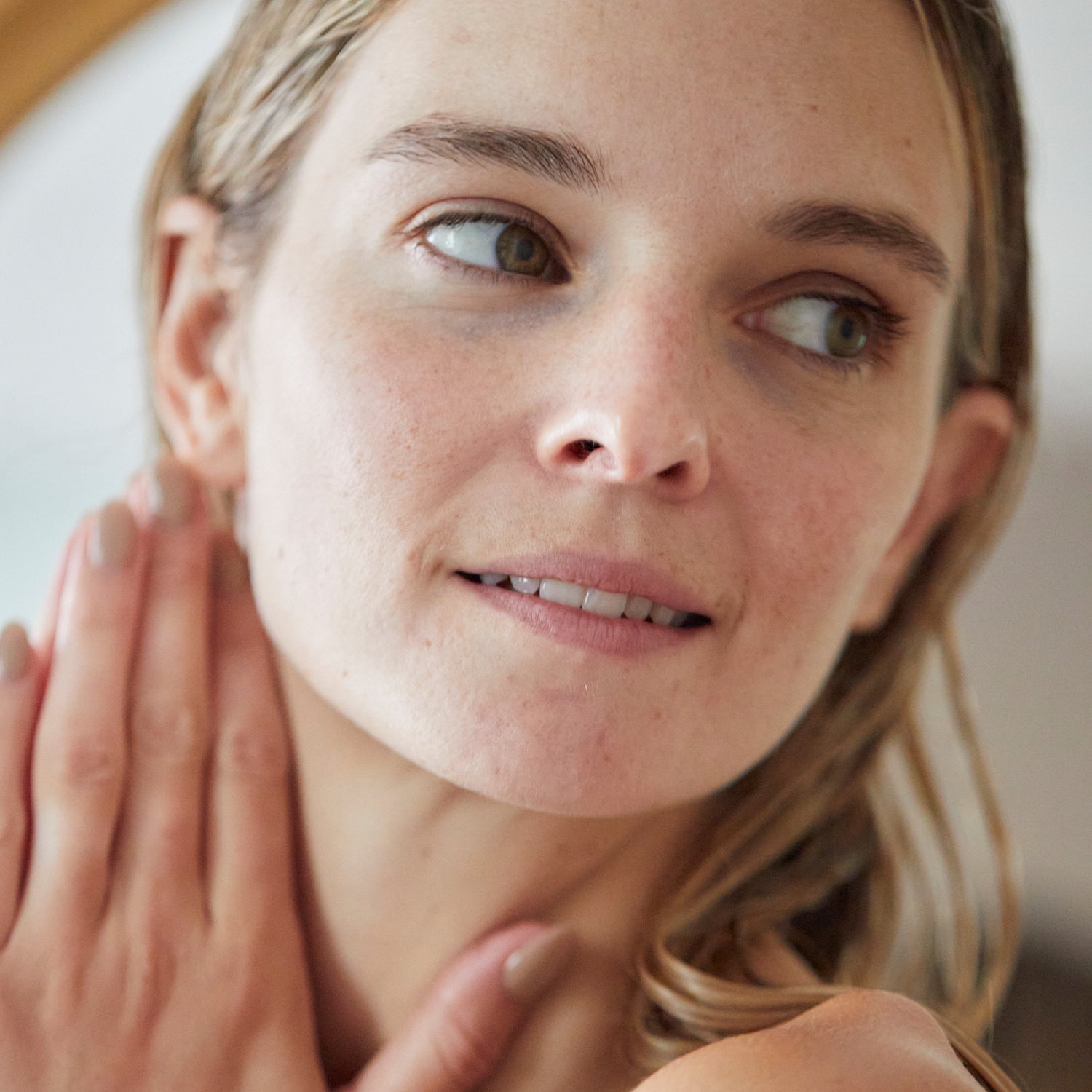 All About Hyperpigmentation